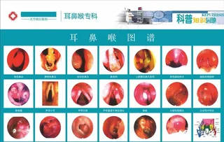 耳鼻喉图片