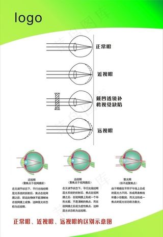 视力健康展板图片