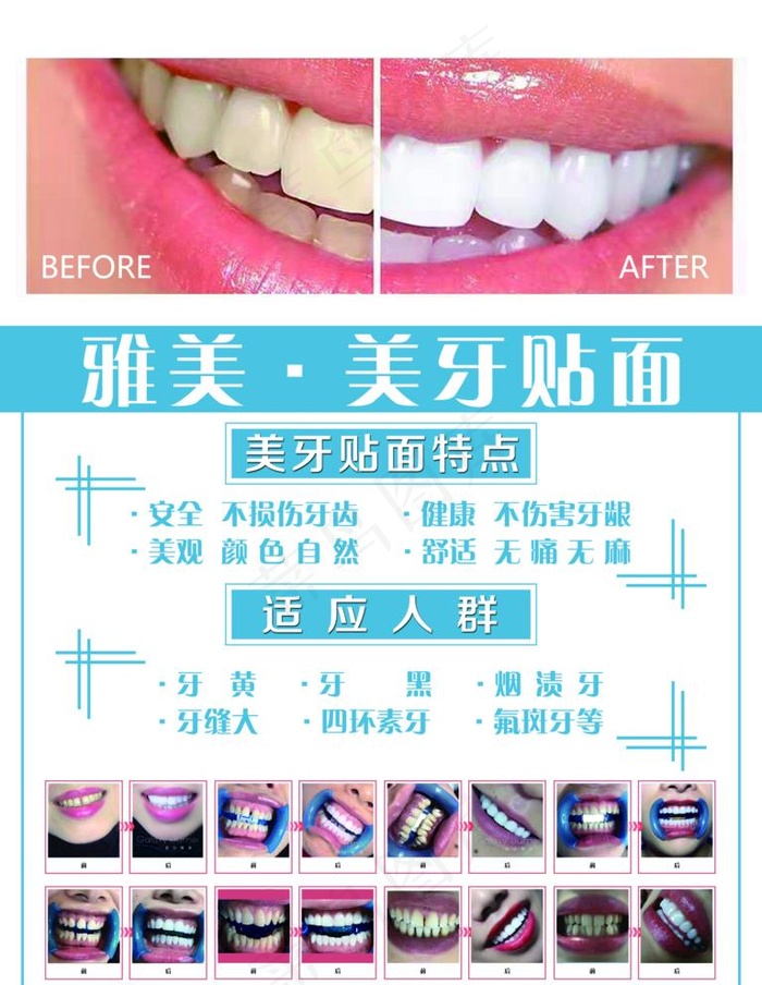美牙海报图片(9000X12000(DPI:381))psd模版下载