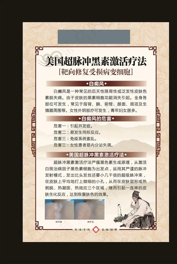 白癜风挂图 皮肤科挂图 展板图片cdr矢量模版下载