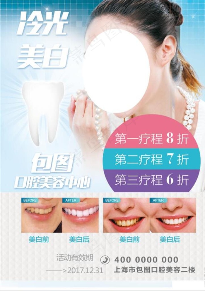 牙齿美白海报图片(4961X6732(DPI:300))psd模版下载