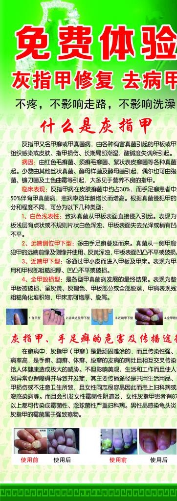 修脚 灰指甲 易拉宝 展架图片
