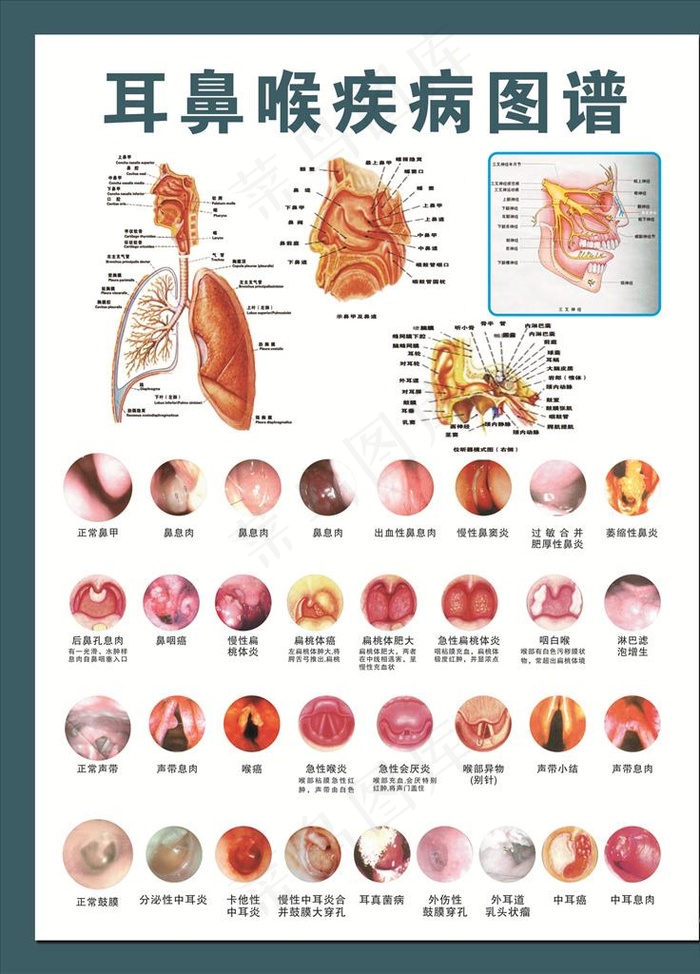 耳鼻喉疾病图谱图片