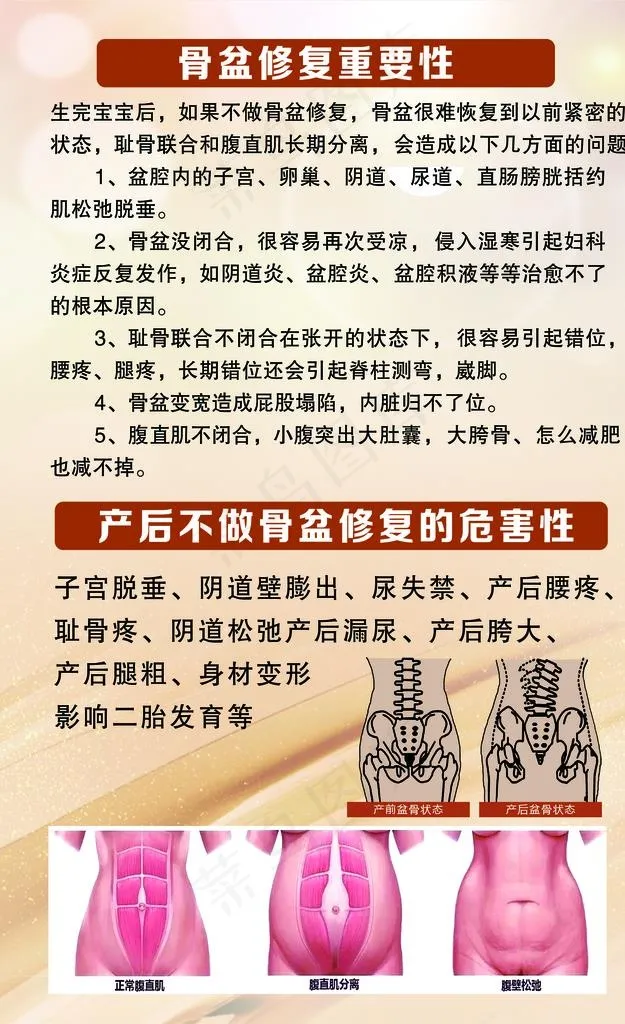 骨盆修复海报图片(1969X3071(DPI:100))psd模版下载