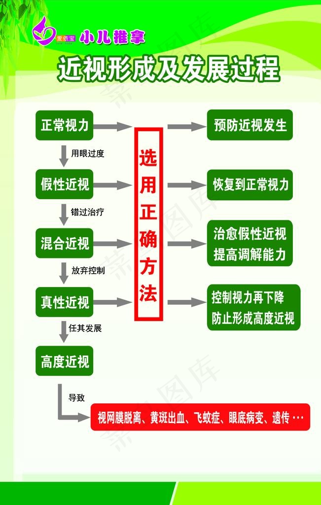 近视形成图片