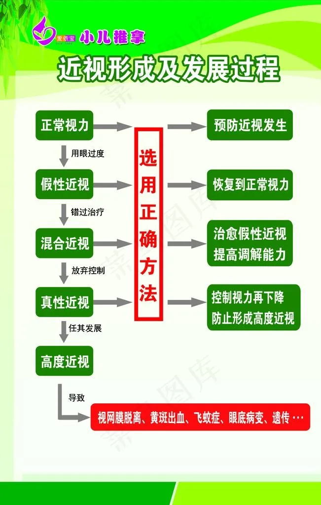 近视形成图片(3543X5315(DPI:150))psd模版下载