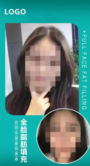 小清新医美对比图图片