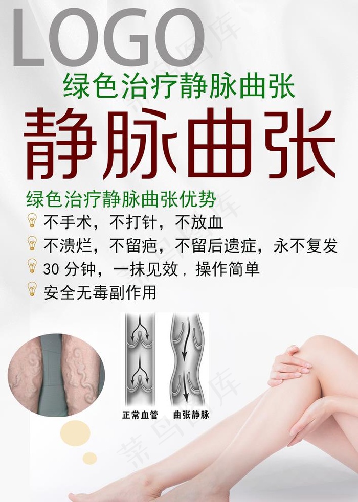静脉曲张图片