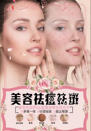美容祛痘祛斑图片