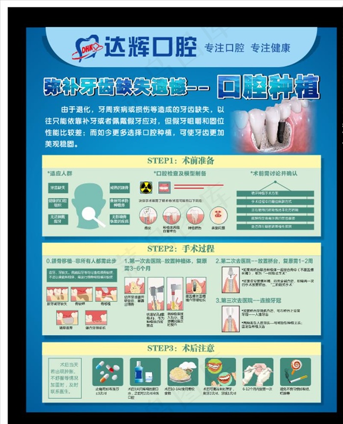 口腔种植海报图片cdr矢量模版下载