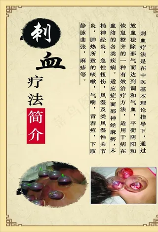 刺血 海报 图片 高清 实用