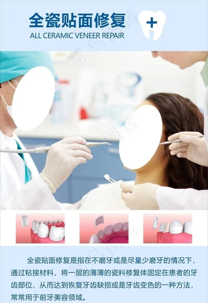 全瓷贴面修复图片cdr矢量模版下载