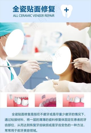 全瓷贴面修复图片