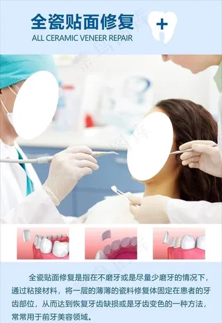 全瓷贴面修复图片
