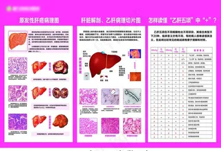 肝病科解剖图图片