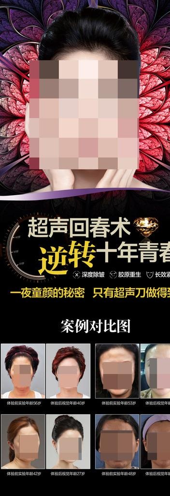 超声刀x展架图片(1701X4535(DPI:72))psd模版下载