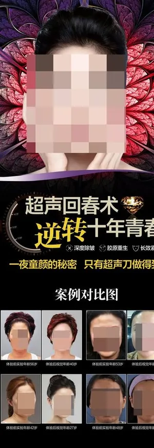 超声刀x展架图片