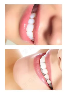 美牙图片 美牙图片