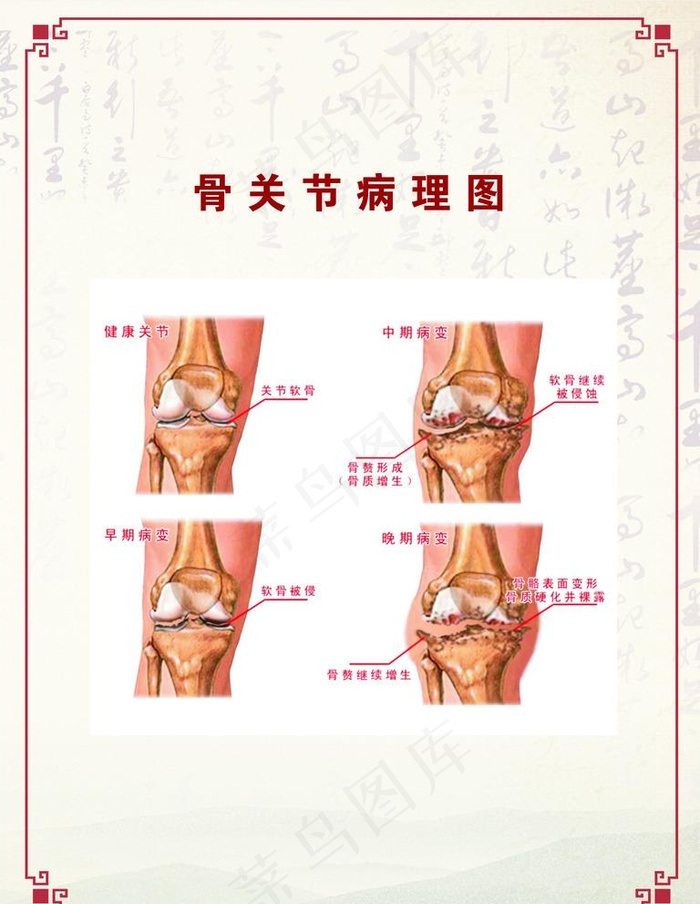 骨关节病理图图片