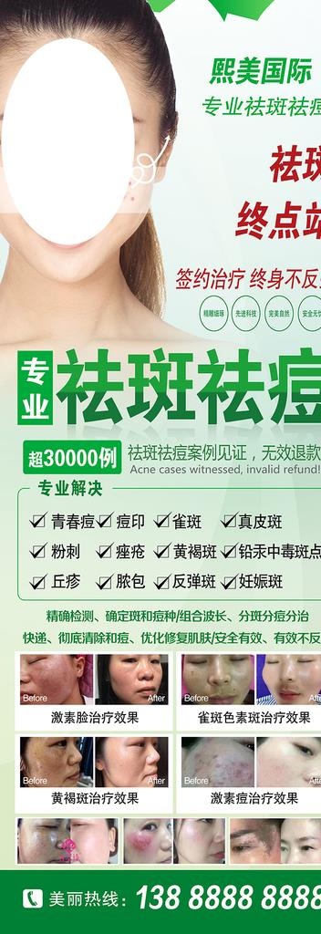 专业祛斑祛痘展架图片(4724X12598(DPI:200))psd模版下载