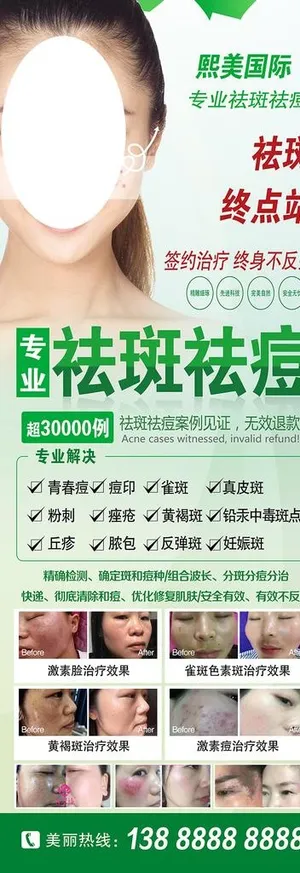 专业祛斑祛痘展架图片