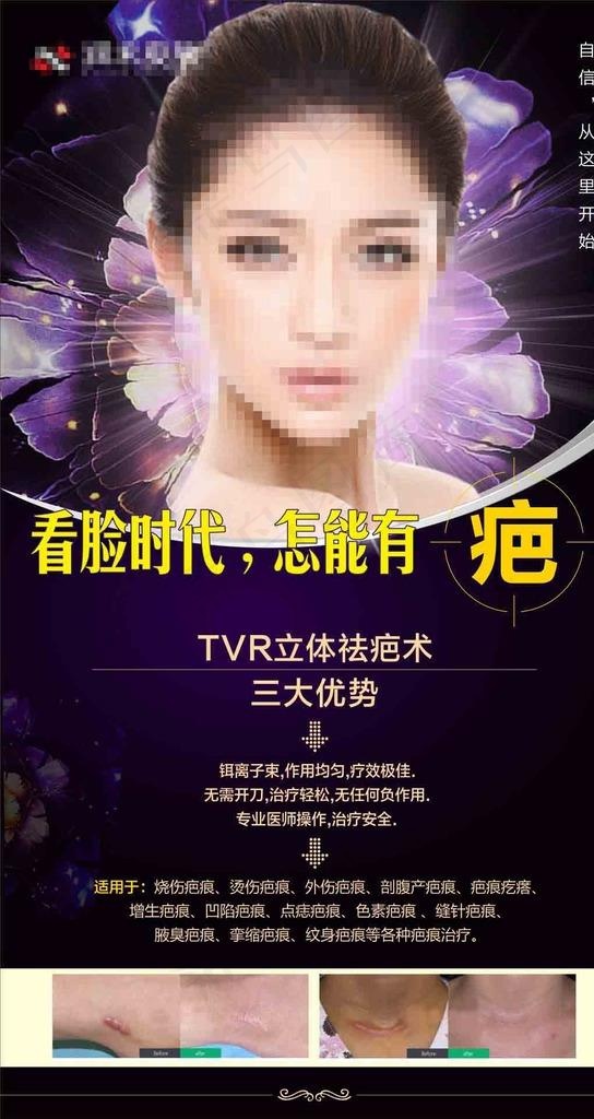 祛疤图片cdr矢量模版下载