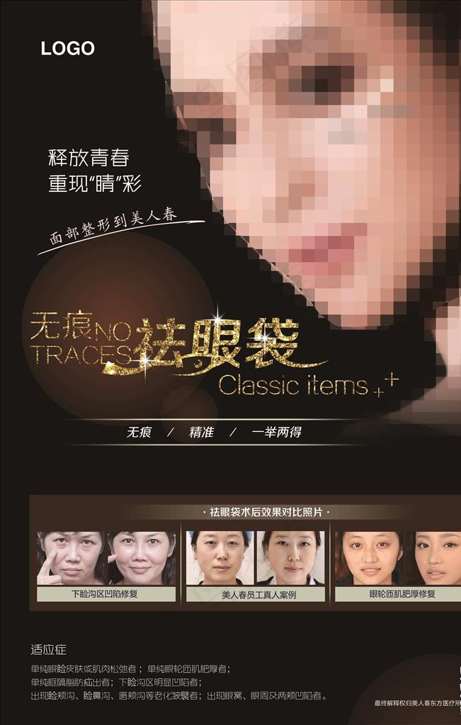 整形祛眼袋图片(4724X7087(DPI:200))psd模版下载
