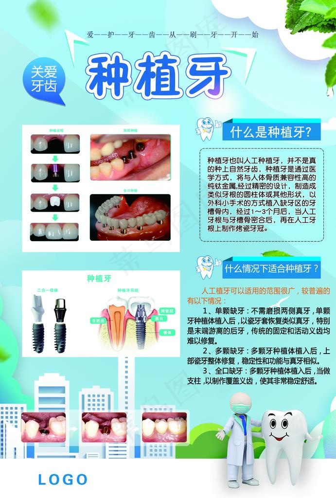 牙科展板 口腔科展板 种植牙图片(3543X5019(DPI:214))psd模版下载