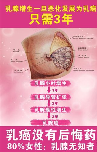 乳腺增生海报图片