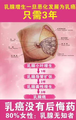 乳腺增生海报图片