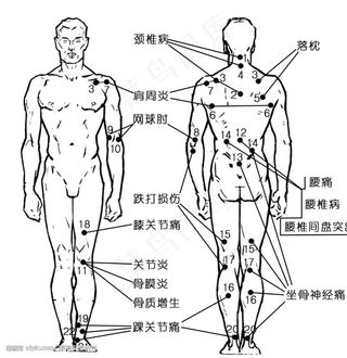 人体穴位图图片
