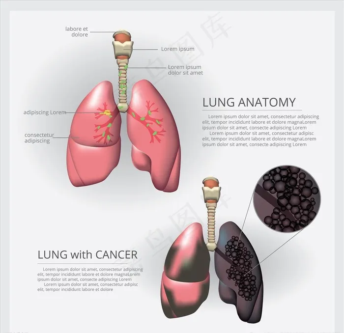 肺炎图片ai矢量模版下载
