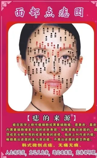 面部点痣图图片