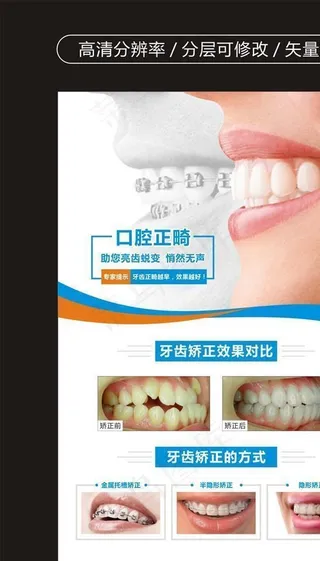 牙科海报 牙科广告 口腔正畸图片