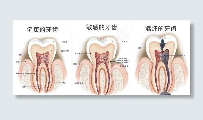 健康的牙齿图片(210X297)cdr矢量模版下载