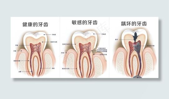 健康的牙齿图片