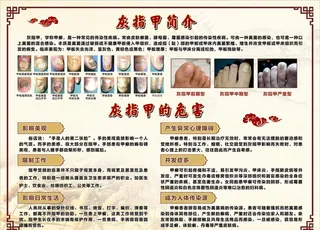 灰指甲的危害 灰指甲简介图片