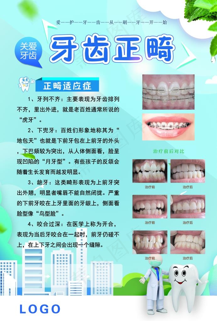 牙齿正畸图片(3543X5019(DPI:214))psd模版下载