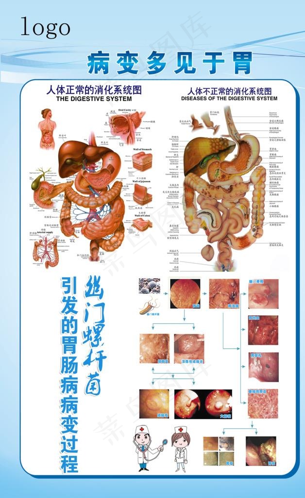 胃肠病变展板图片psd模版下载