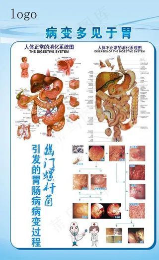 胃肠病变展板图片