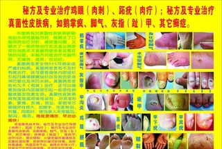 鸡眼 肉刺 脚气 灰指甲图片