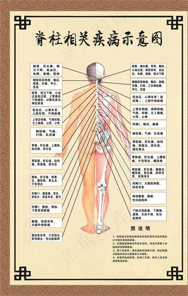 脊柱相关疾病示意图图片cdr矢量模版下载