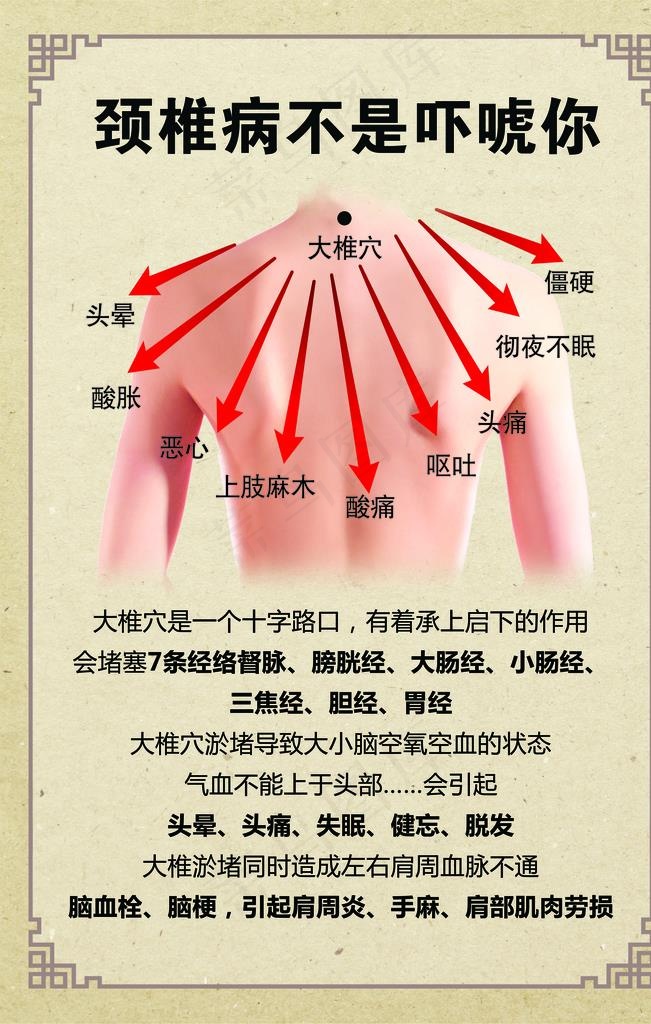 颈椎病图片(3543X5315(DPI:150))psd模版下载
