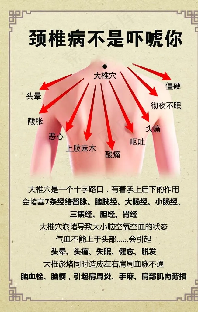 颈椎病图片(3543X5315(DPI:150))psd模版下载