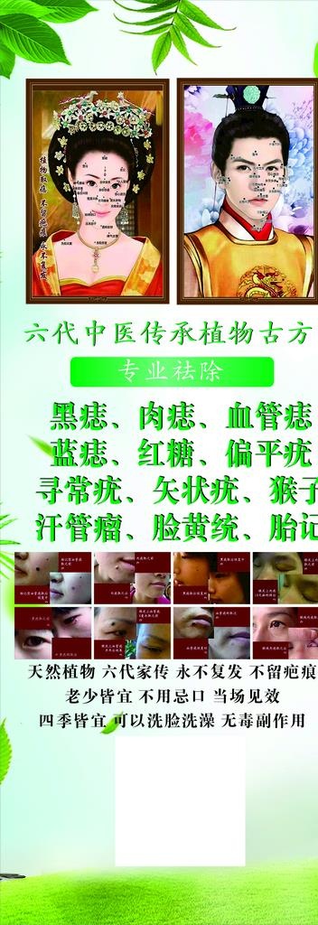 点痣展架图片