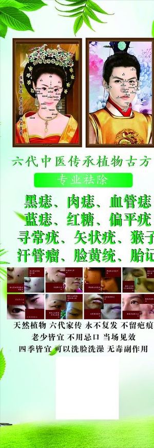 点痣展架图片
