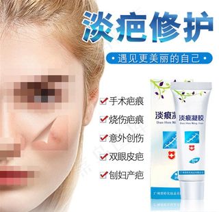 去疤膏图片