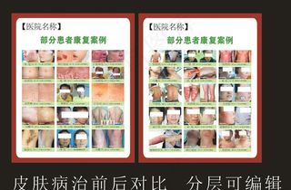 皮肤病治疗对比图图片