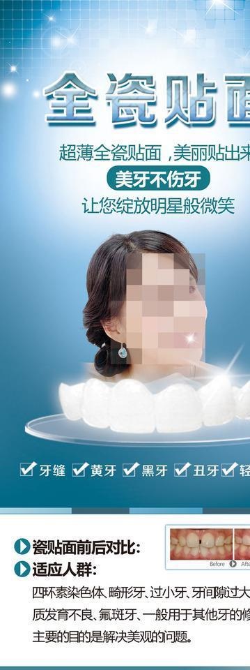 瓷贴面图片(2268X5102(DPI:72))psd模版下载