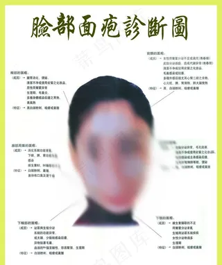 脸部面疱诊断图图片